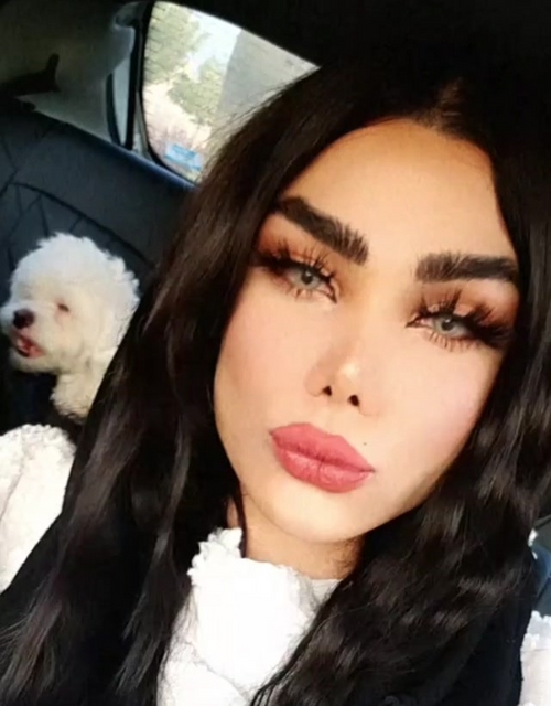ترنس بودن رها