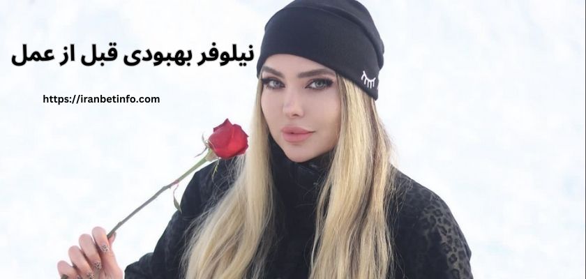 قیافه نیلوفر بهبودی قبل از عمل چگونه بود؟